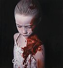 Gottfried Helnwein, The Disasters of War 39, 2014, 185 x 173 cm, mixed media - oil and acrylic on canvas